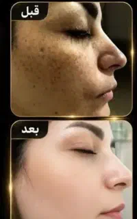 پاکسازی عمیق و بازسازی پوست با تکنولوژی روز