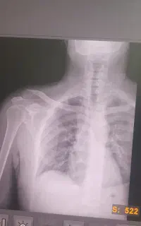 نیاز به راننده پایه یک