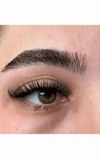 کاشت مژه