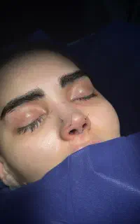 رینو پلاستی