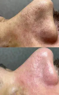 خدمات  فیشیال  و جوانسازی