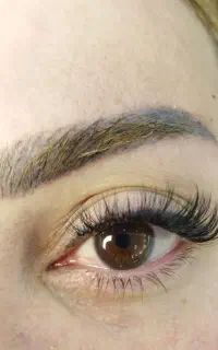 کاشت مژه
