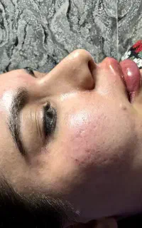 اولین مرکز سوپرکانتورینگ غبغب و بلفاروپلاستی