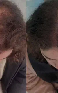 پکیج آلفا بی نظیره