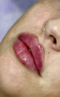 ژل لب M تکنیک