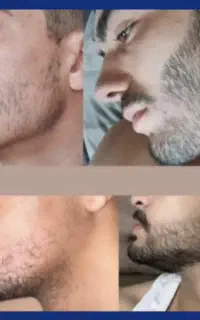 شامپو و سرم پرپشتی مو و ریش