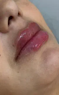 لب زیباتر، با طراحی مخصوص چهره تو