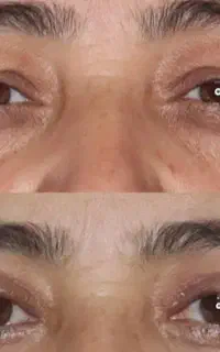 مژده مژده بلفا با قیمت باورنکردنی