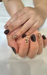 کاشت ناخن ۳۰۰