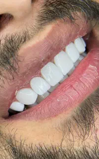 دندانپزشکی کامپوزیت فکی فقط (۱۷)م ارتودنسی