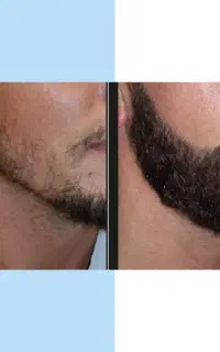تقویت حرفه ای