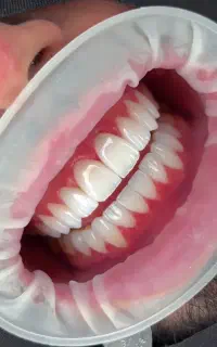 خدمات دندان پزشکی در کلینیک درمانگاهی