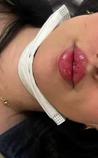تزریق ژل و بوتاکس وآموزش تخصصی