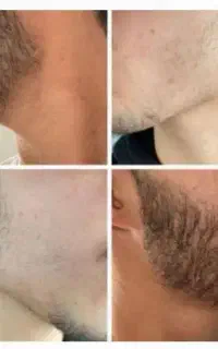 ریشات وقتشه پر پشت بشه
