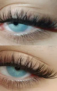 کاشت تخصصی مژه هیدن