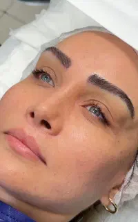 بلفارو
