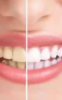 لمینت اور سفید و براق