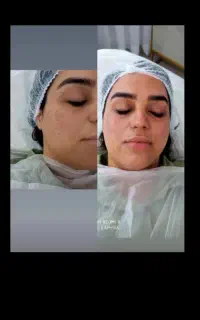 خدمات لاین پوست