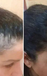 این آخرین روش که امتحان میکنی
