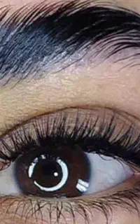 مژده برای کاشت و لیفتینگ و آموزش