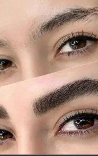 میکرو بلیدینگ و فیبروز  ابرو