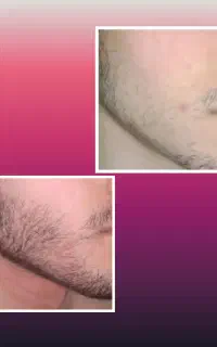 با یک دوره مصرف به نتیجه برس