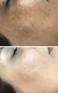 برای زیبایی تلاش کن