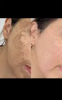 تخفیفات ۲۰ درصدی پی ارپی سابسیژن اموزش پی ارپی