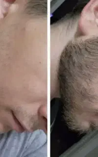 دیگه نیازی به کاشت نیست