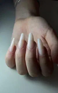 کاشت تخصصی ناخن