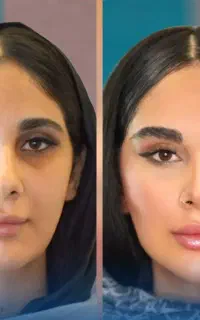 آف پکیجPRO FACE پزشک پوست مو بینی ابرو غبغب زیبایی