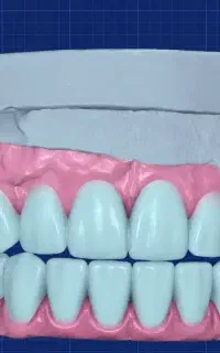آموزش دندانسازی دیجیتال (طراحی با اگزوکد+ساخت)