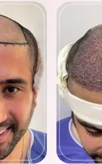 تخفیفات کاشت