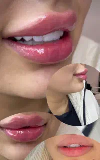 کلینیک زیبای تزریق فیلر و بوتاکس