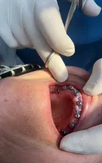 دندانپزشکی با اقساط بلند مدت بدون سود