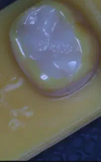 ترمیم دندان