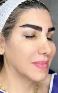 کاشت ابرو طبیعی متد فاین برو نیدل بنفش خواب طبیعی