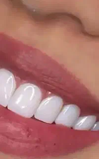 جشنواره دندان پزشکی/ اقساطی/۶