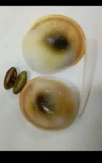سنگ مهره