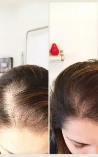 ریش دار شو تا ریشه دار باشی