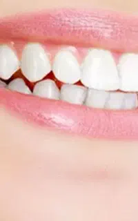 نوبت گیری دندان پزشکی