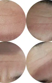 جوانسازی پاکسازی