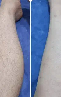 خدمات اپلاسیون
