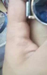 اشیاع کلکسیونی