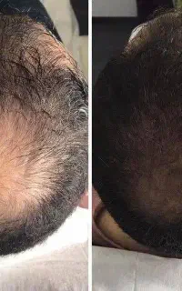 این اخرین روشیه که امتحان میکنی