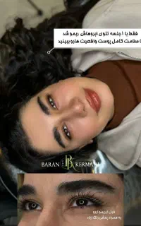 ریمو ابرو