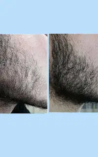تقویت ریشه