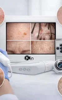 آنالیز دستگاهی پوست و مو/خدمات تخصصی