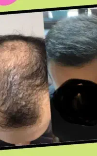 موی بلند