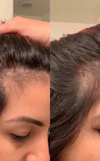 سلامتی موهات به دست بیار